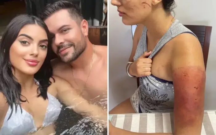 Fotos antes e depois da agressão | Foto: Isabella Santos/Reprodução