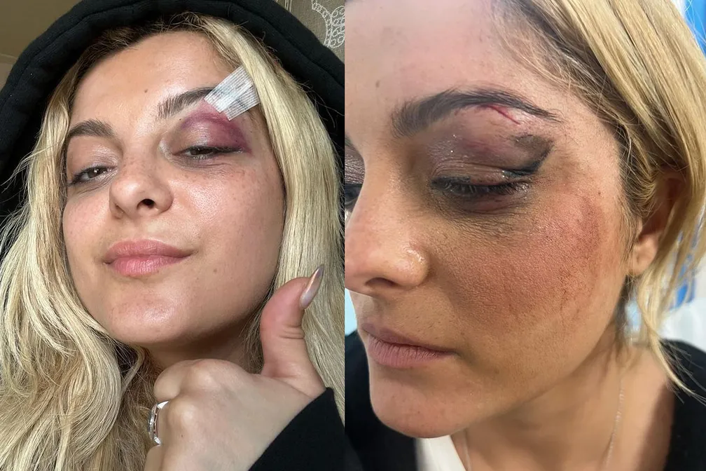 Nesta segunda-feira (19), a artista veio até as suas redes sociais e afirmou na legenda das fotos compartilhadas que ela estava "bem" | Foto: Reprodução/Instagram