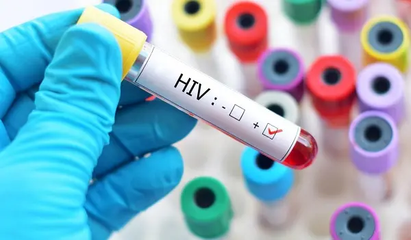 HIV-Aids