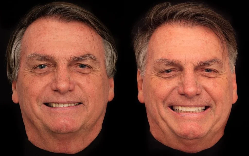 O ex-presidente passou por uma harmonização em todos os seus 28 dentes | Foto: Reprodução
