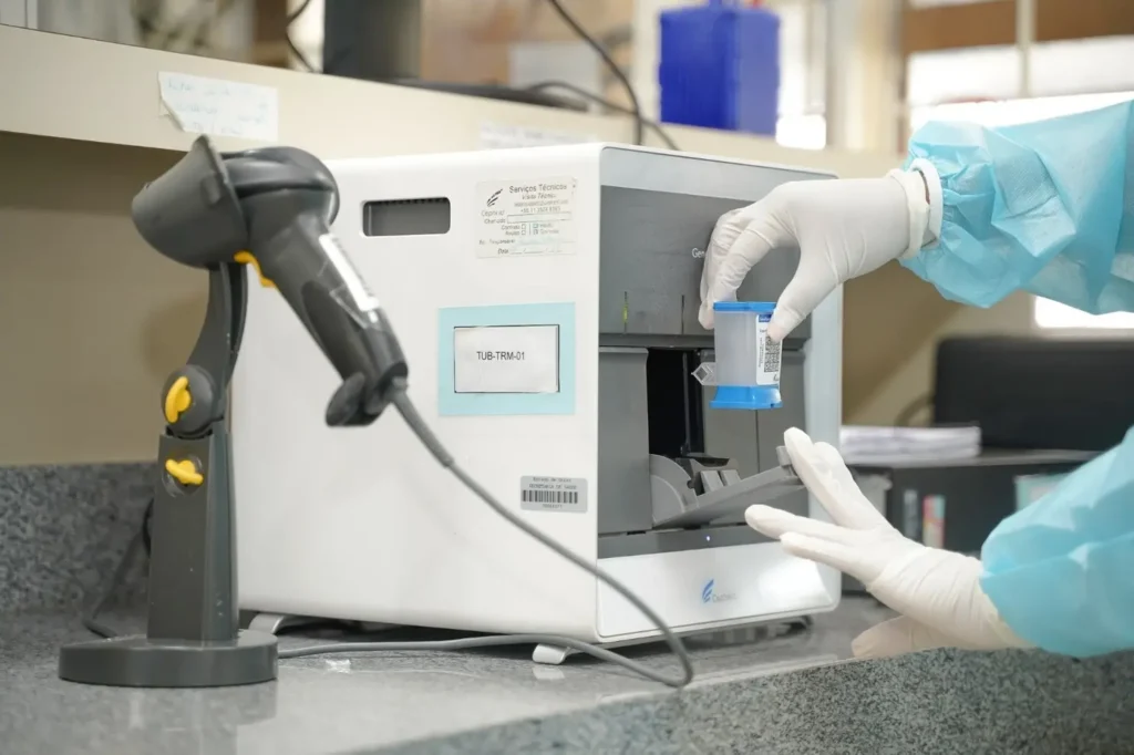 Detecção da doença foi ampliada ao longo do ano por meio do Teste Rápido para Tuberculose (TRM-TB) | Foto: Iron Braz