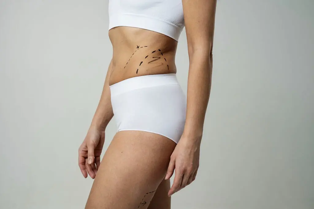 bodytite