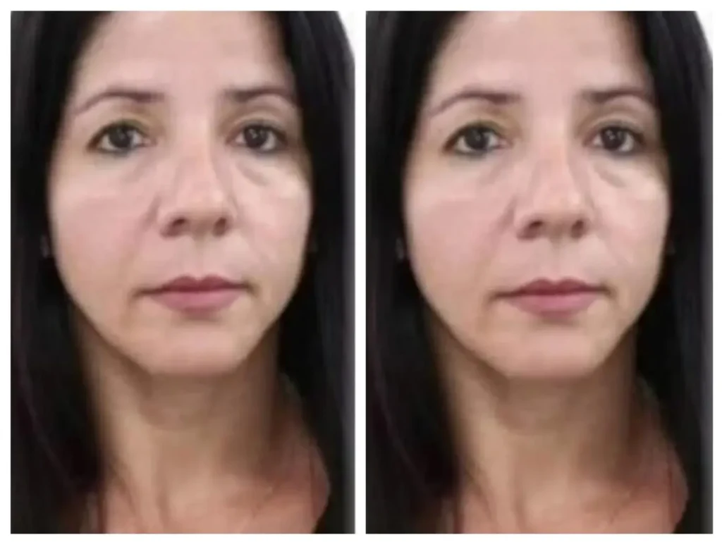 Fabia Cristina Santos está desaparecida desde o dia 9 de março I Foto: Reprodução