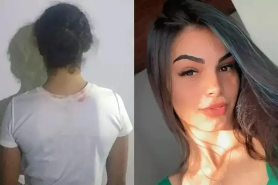 A suspeita disse à polícia que jogou uma mistura de água e soda cáustica na vítima I Foto: Divulgação/PM/Reprodução