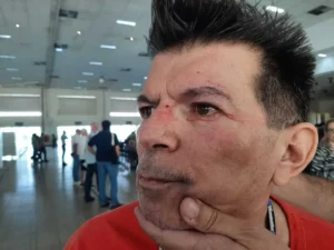 Professor que levou soco em assembleia da UFG. Imagem/Reprodução