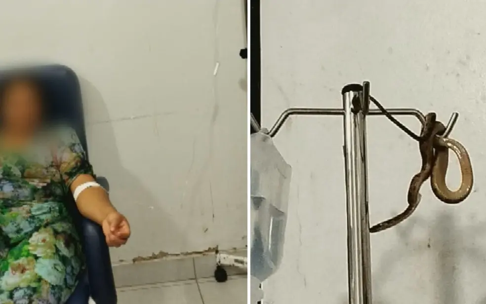 A paciente contou ainda que há menos de um ano, viu outra cobra na mesma unidade de saúde I Foto: Reprodução/TV Anhanguera
