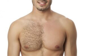 Pelos masculinos:  até quando?