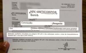 Após resultado errado de teste de HIV