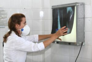 Brasil se aproxima de padrão positivo de combate à tuberculose