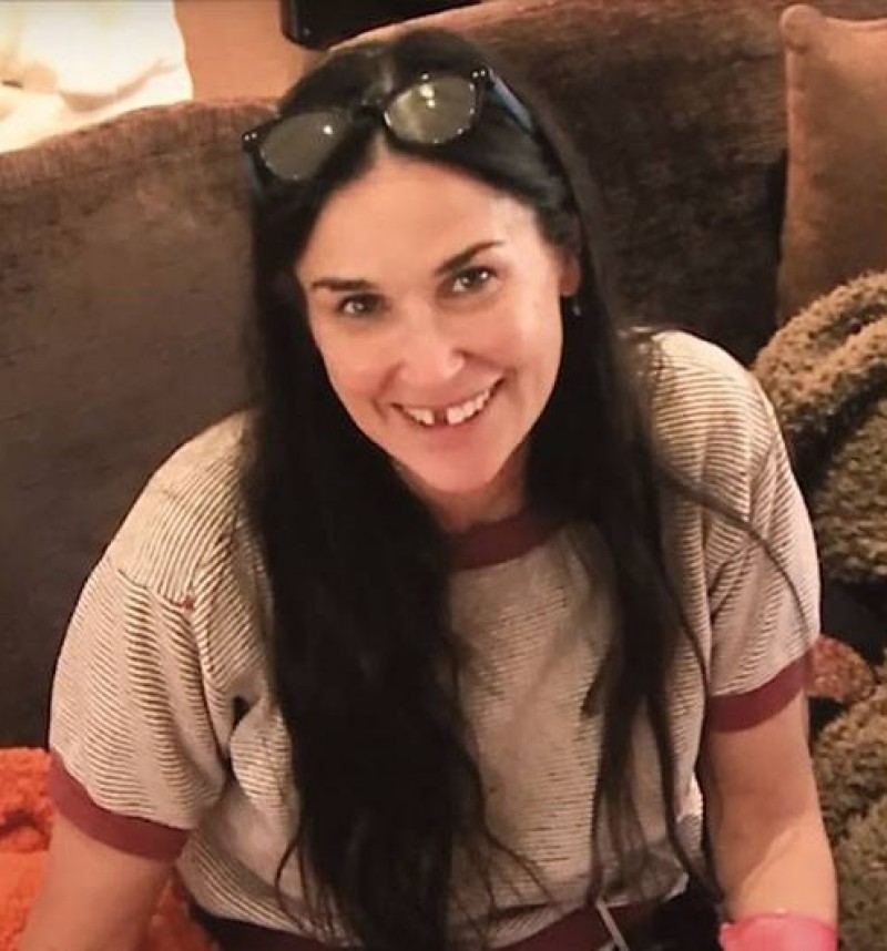 Demi Moore conta que perdeu dentes por estresse