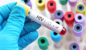 Entenda o caso da argentina que pode ter se curado do HIV pelo seu próprio sistema imunológico