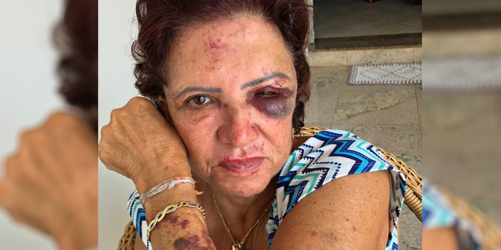 Ex-primeira-dama de Itaberaí é agredida durante assalto