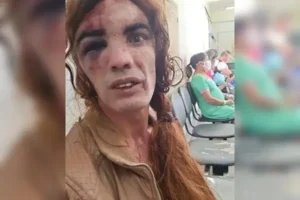 Suspeito de agredir mulher trans é  identificado