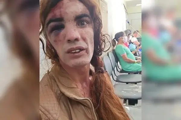 Suspeito de agredir mulher trans é  identificado