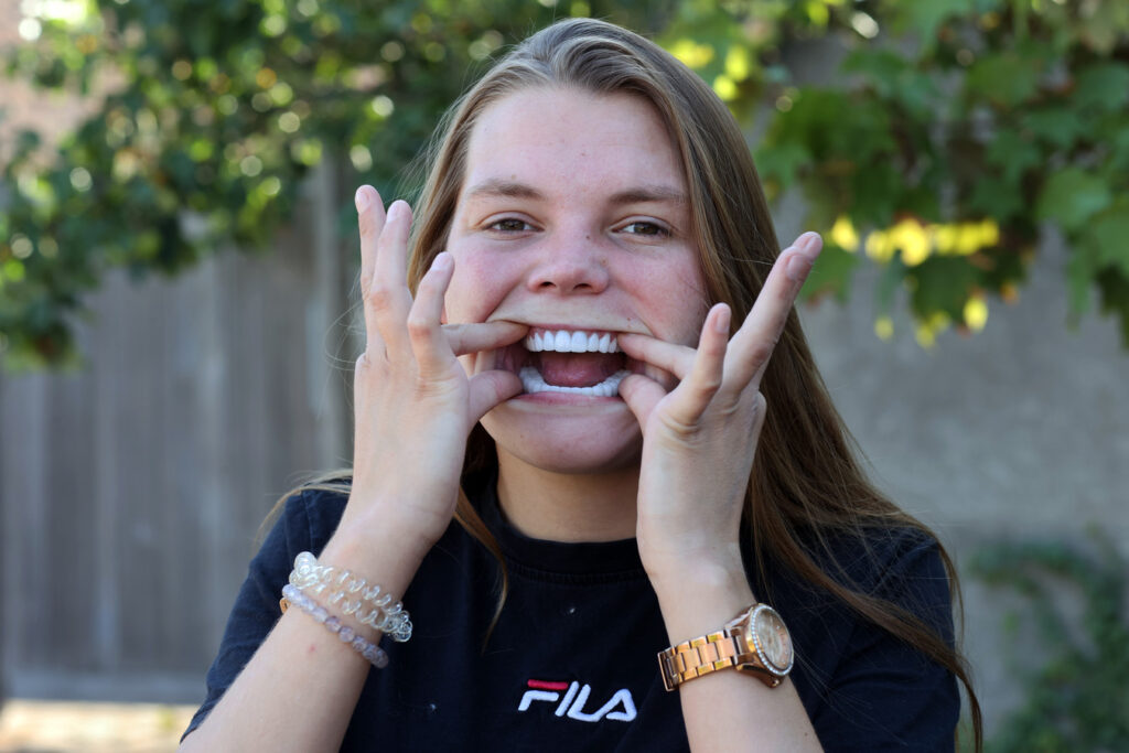 Mulher perde todos os dentes