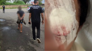 Mulher é presa em flagrante por agredir idosa com garrafa e causar perda de visão em Anápolis Foto: Divulgação