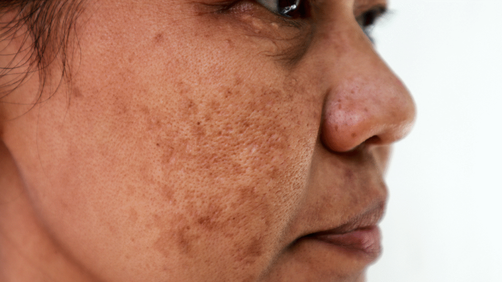 IMAGENS 2025 05 22T231838.286