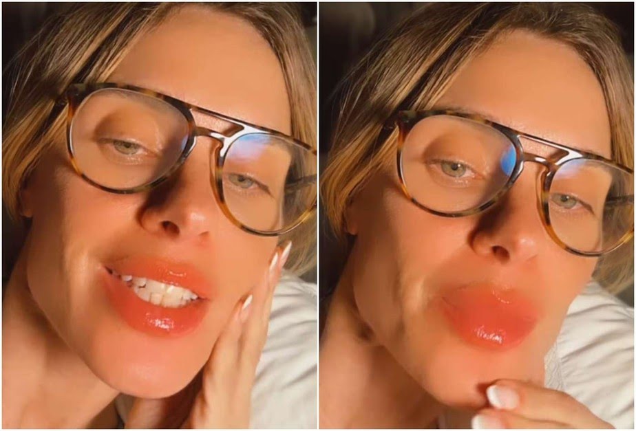 Carolina Dieckmann relata reação alérgica nos lábios após voo