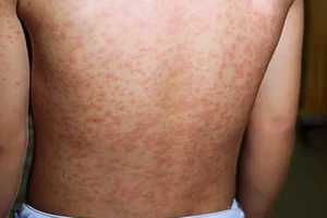 685eebebeb8235f480d3467a 62e7bd2d061807c42bbdc7b0 tMjKNDc0hJX5jvj 52sou2MwIDbFYrPiXxJdoSgNDduDeWDIT4bdLpB7toMUMz80llhDXYqJt9bQzwuIz1PX7fKbrGAxlUAfVctyCGjrtHXrLEGkzTvtRmnaguYVQbC n30r6vbidkKxfQr7YNzXwQ