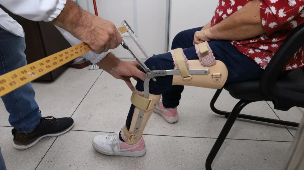 Oficina Itinerante do Crer oferece atendimento ortopedico em Caldas Novas de 07 a 11 de julho