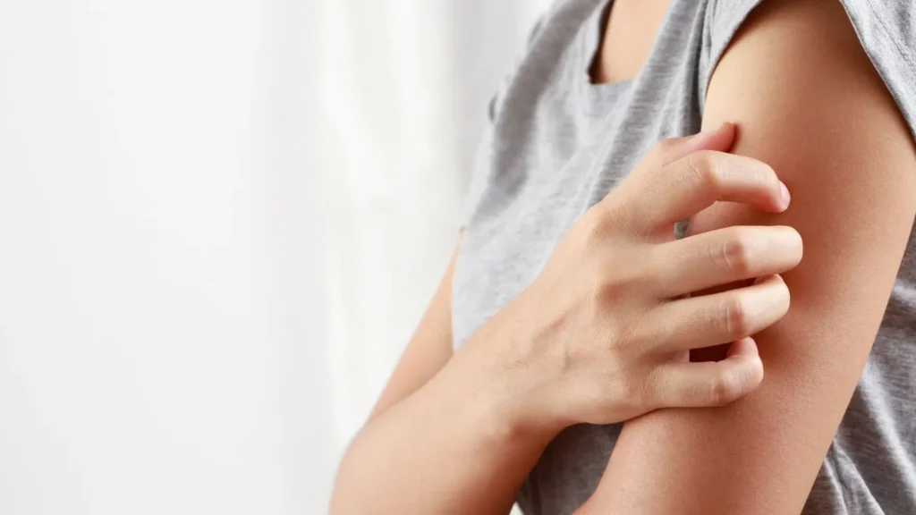 Manchas e vermelhidão na pele podem ser sinais de alergia emocional desencadeada pelo estresse.| Foto: Reprodução/canva