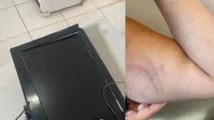 O Brasil esta entre os paises com mais mortes no transito