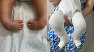 Até o momento, 16 cirurgias já foram realizadas na unidade. | foto: divulgação