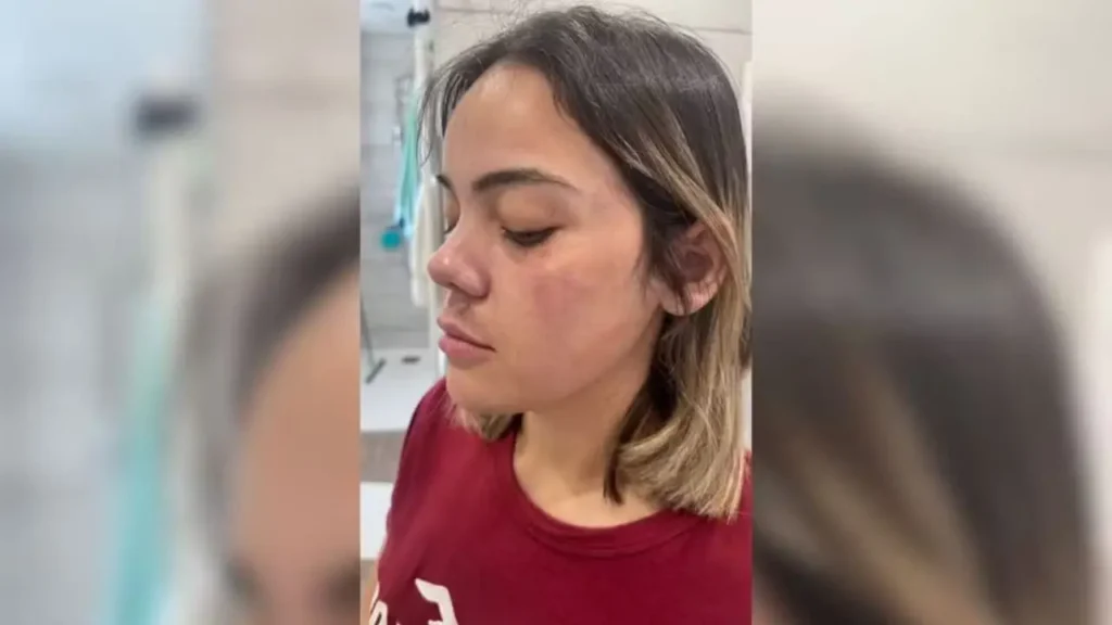 Goiana de 26 anos sofre tentativa de estupro no metrô de Paris e fica ferida durante o ataque 2 Paris