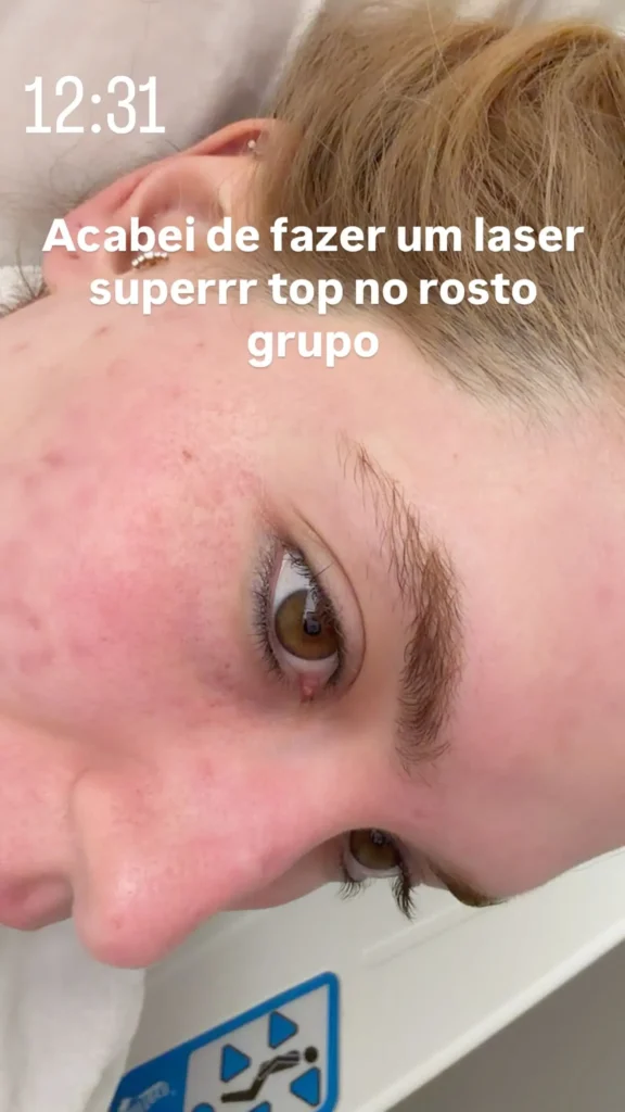 Virginia Fonseca passa por procedimento estético inédito com médico goiano 2 Virginia