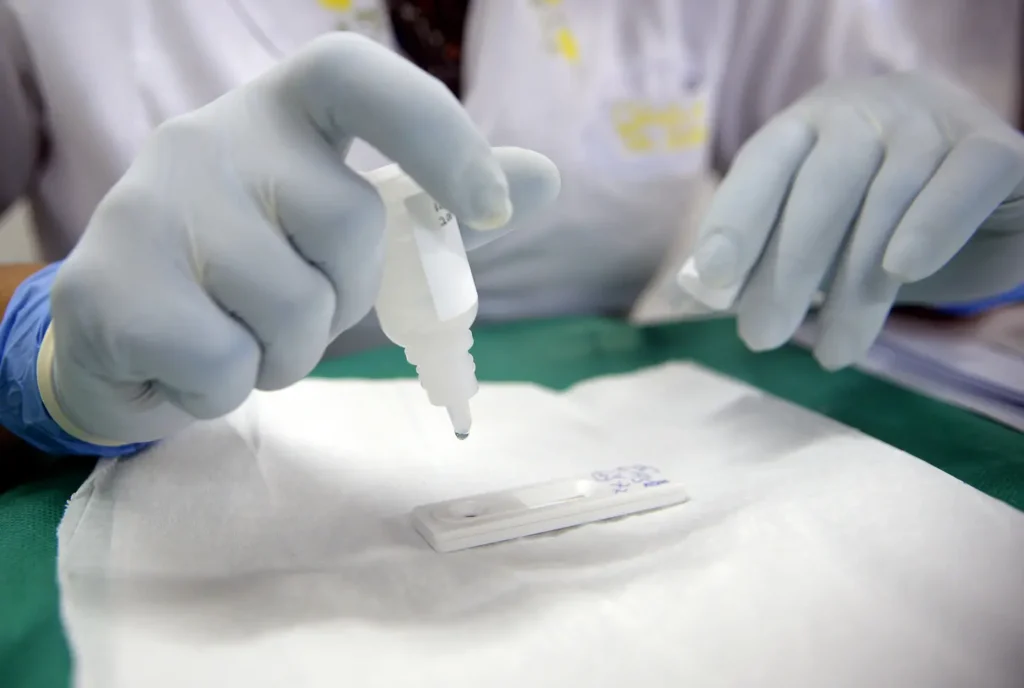 Sífilis cresce entre gestantes e amplia risco para recém-nascidos 3 sífilis