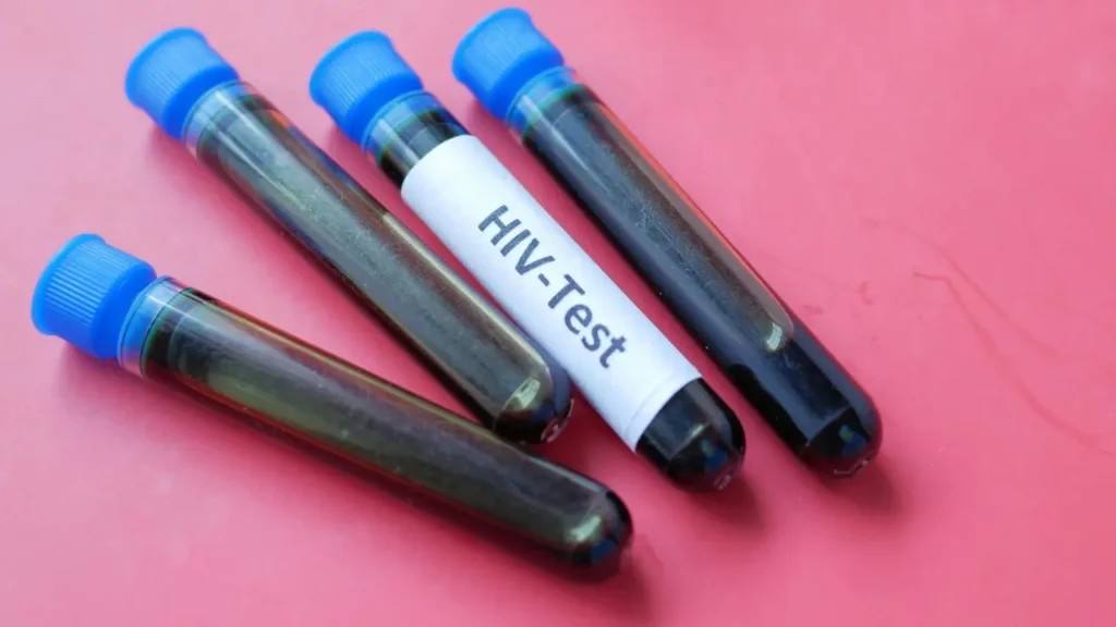 Sétima remissão prolongada do HIV após transplante de células-tronco 2 IMAGENS 2025 12 10T214555.231