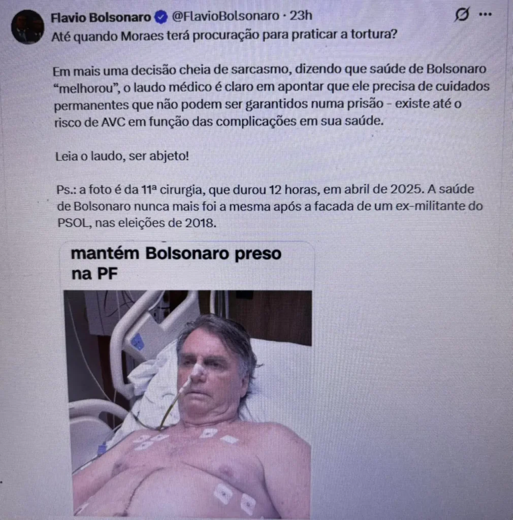 Prisão de Bolsonaro