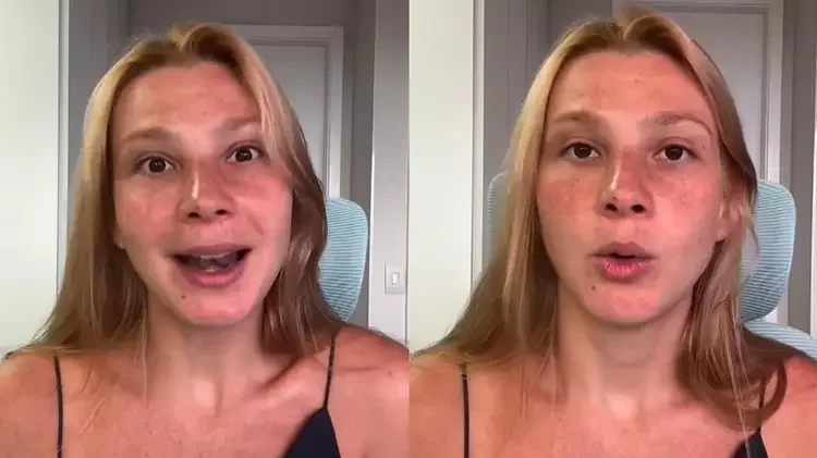 Modelo de 32 anos sofre AVC e revela sinais ignorados antes do diagnóstico 2 AVC