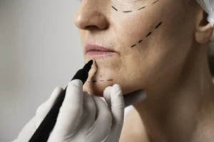 woman with marker traces face close up