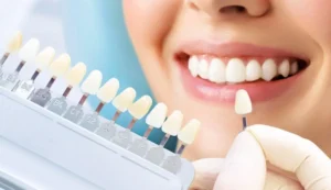 estetica dental scaled 1