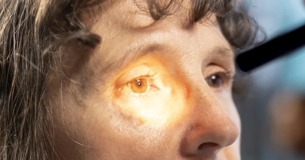 9 abre 1 Abril marrom Foto Freepik e1776821319976