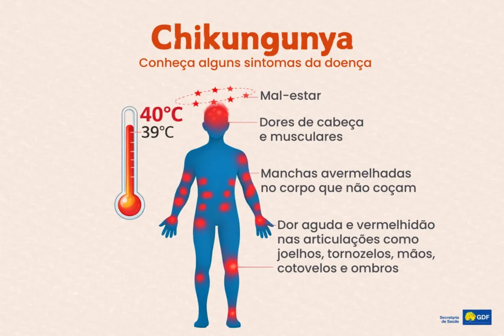 Chikungunya