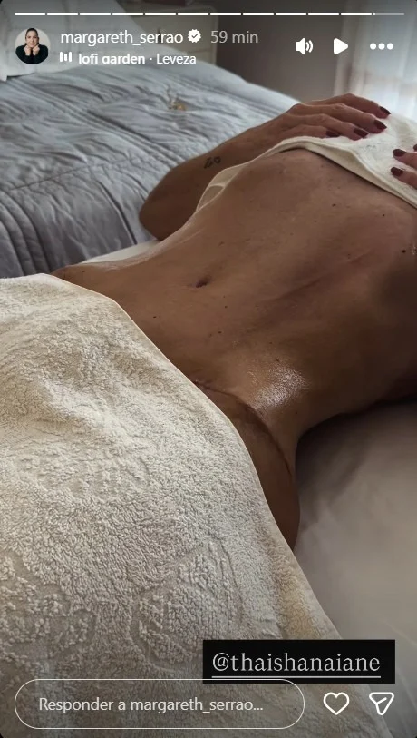 margareth serrao surge irreconhecivel apos plasticas e virginia reage 3236117