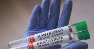 hantavirus amostrar 4 e1778184374651