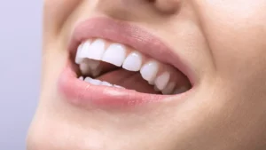 alimentos bons para os dentes