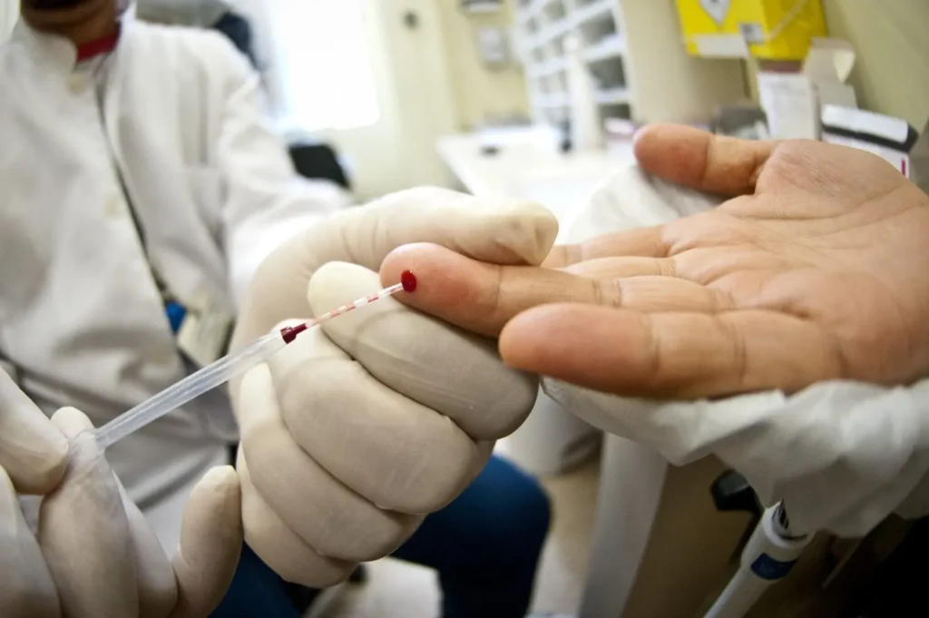 teste hiv aids