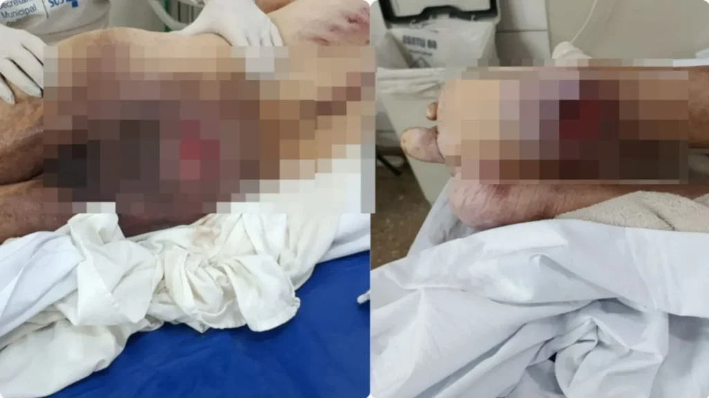 Idoso é encontrado em estado grave e caso de possível negligência termina com prisão em flagrante em Goiânia