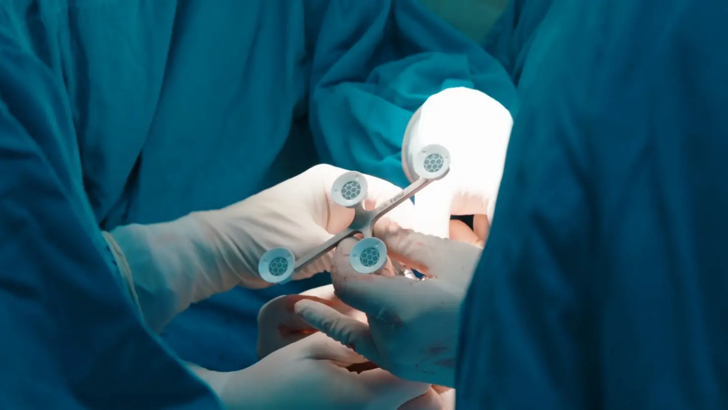 Robô chinês estreia em cirurgia ortopédica no Brasil
