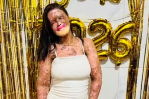 Doença rara que matou influenciadora tem alta incidência em Goiás