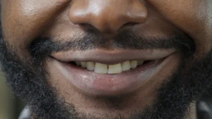 Dentes amarelados