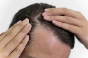 cabelo