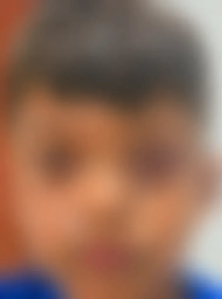 Túlio Isac Filho denuncia que filho teve rosto queimado com cigarro e olho roxo