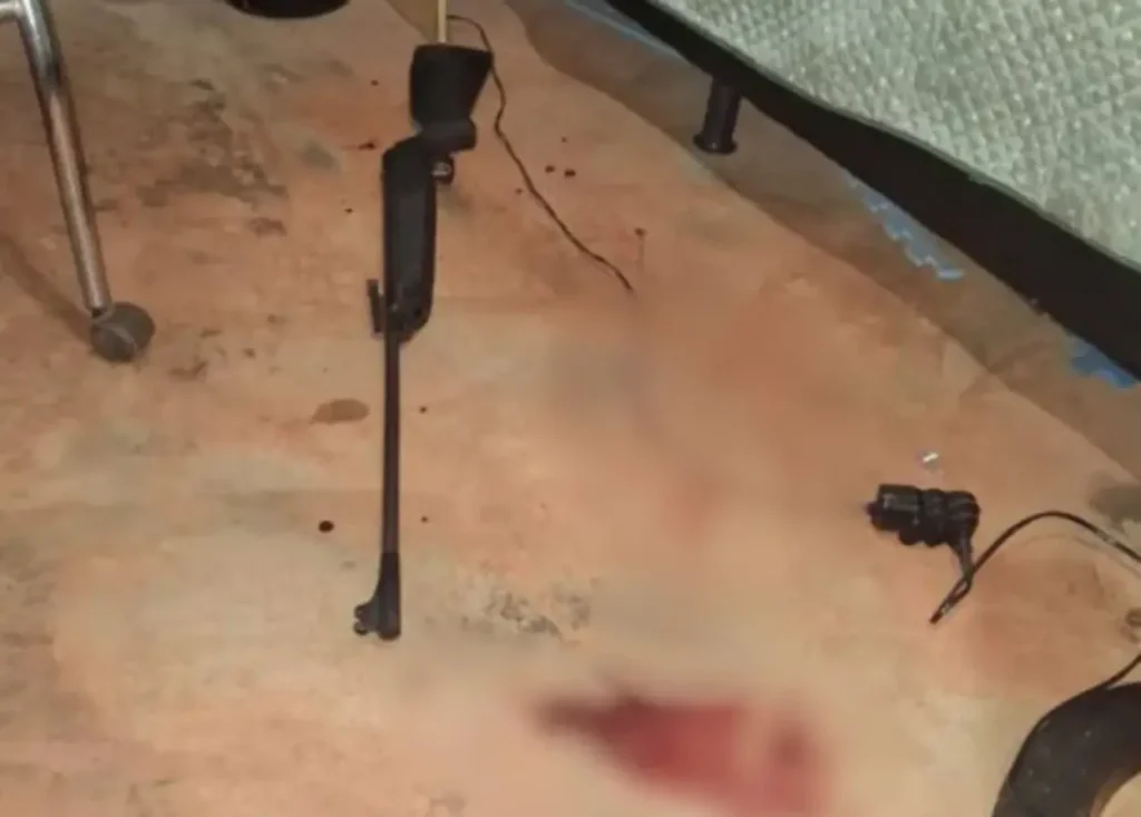 Criança de 10 anos fica em estado gravíssimo após disparos de arma de pressão em Palmeiras de goiás