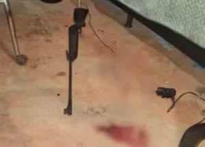 Criança de 10 anos fica em estado gravíssimo após disparos de arma de pressão em Palmeiras de goiás