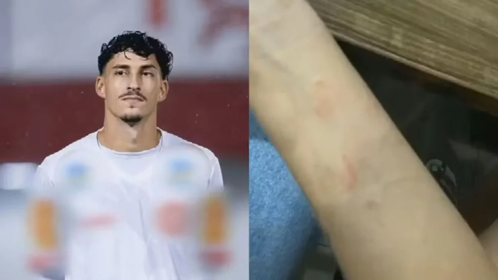 Jogador do Rio Verde é preso suspeito de agredir namorada durante festa
